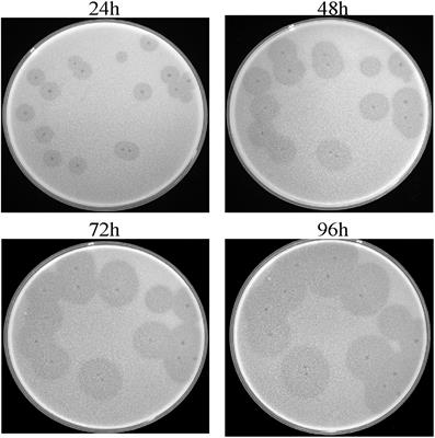 Identification of a Novel Acinetobacter baumannii Phage-Derived Depolymerase and Its Therapeutic Application in Mice